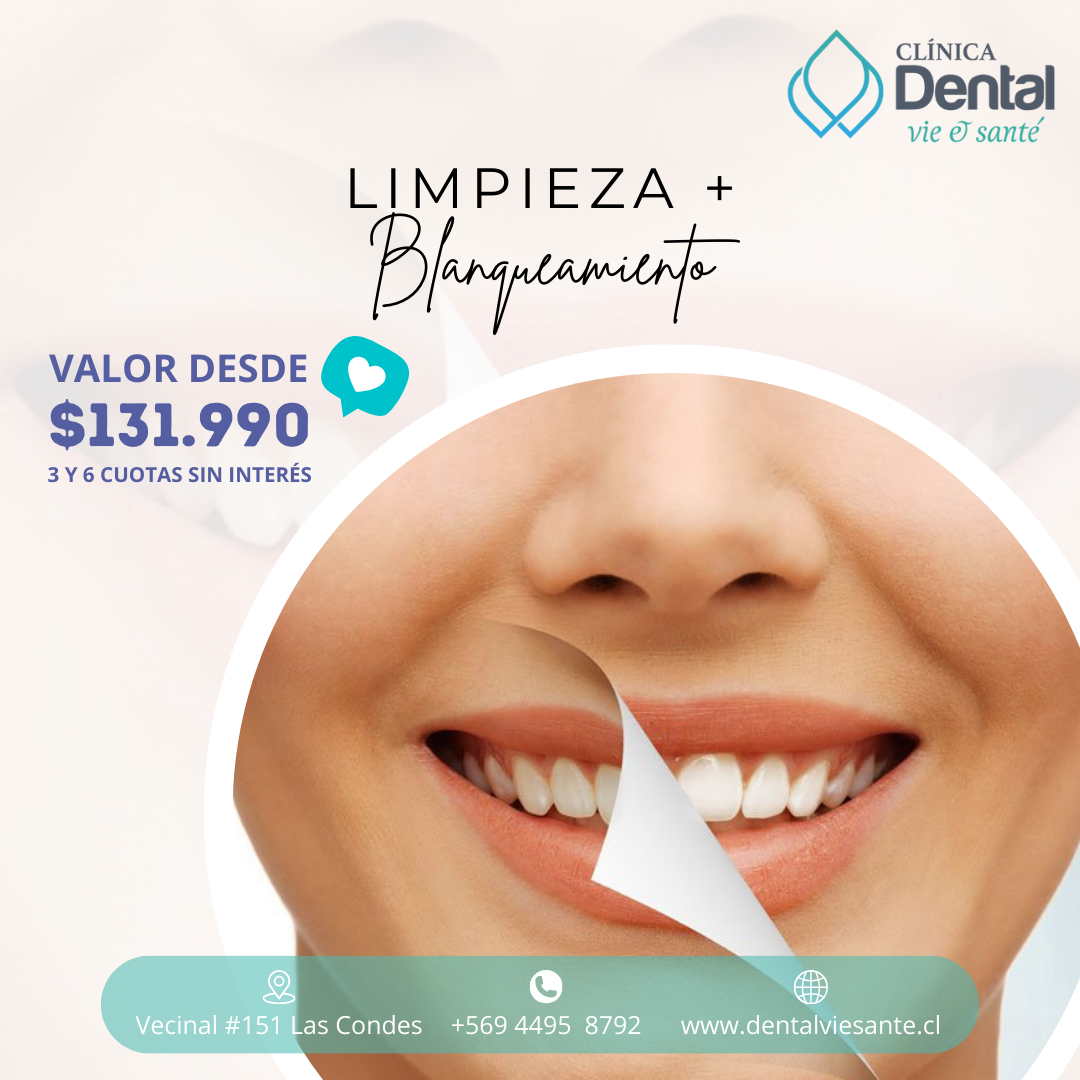 Limpieza + Blanqueamiento Dental