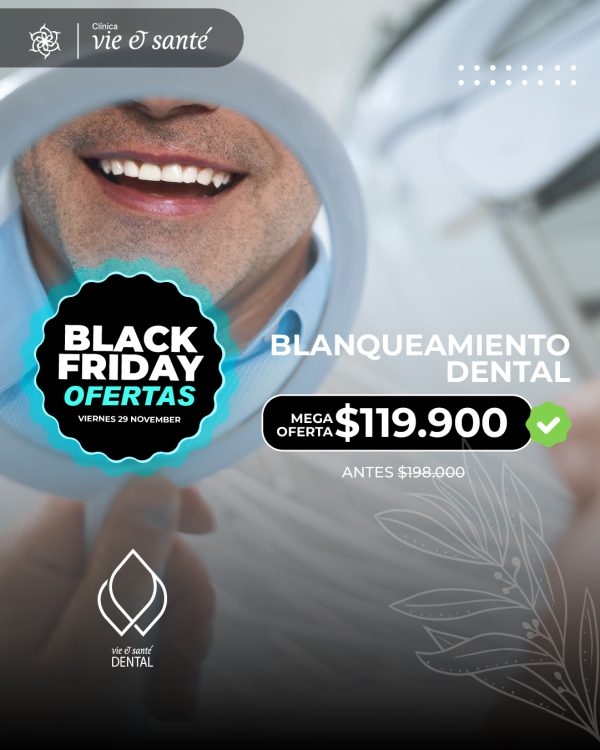 Blanqueamiento Dental